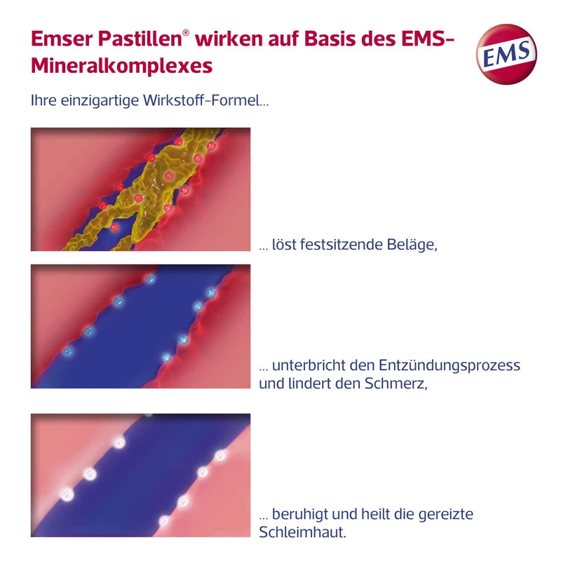 Emser Pastillen Halstabletten ohne Menthol - Bei Halsschmerzen, Husten und starker Stimmbelastung - 30 Stück
