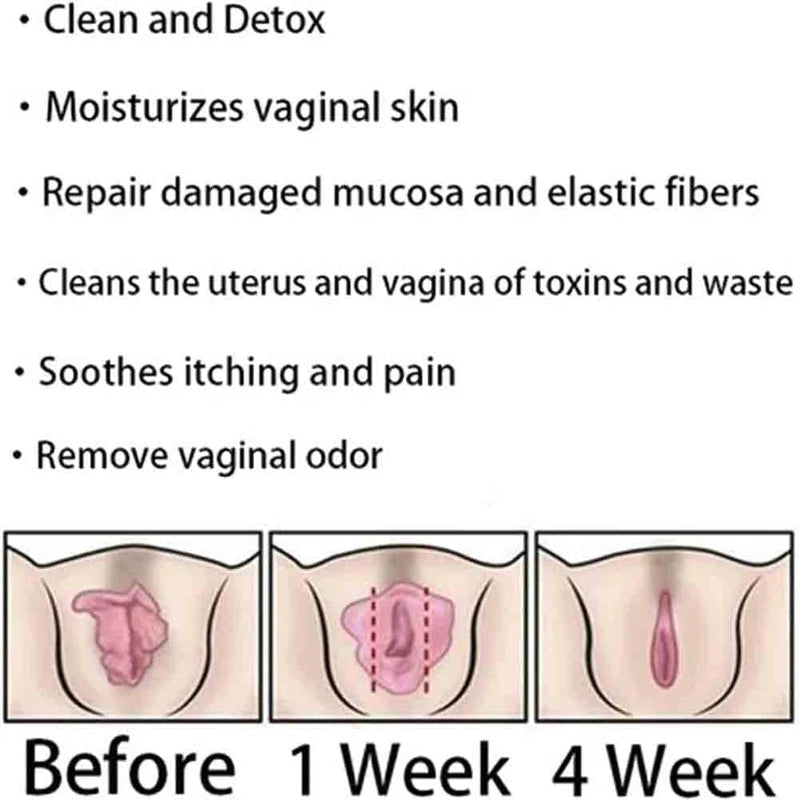 AnnieCare Instant Anti-Itch Detox Products, Annie Care Capsulas, Firming Repair & Pink and Tender Natural Capsules, Annie Care Capsulas (8Bag)