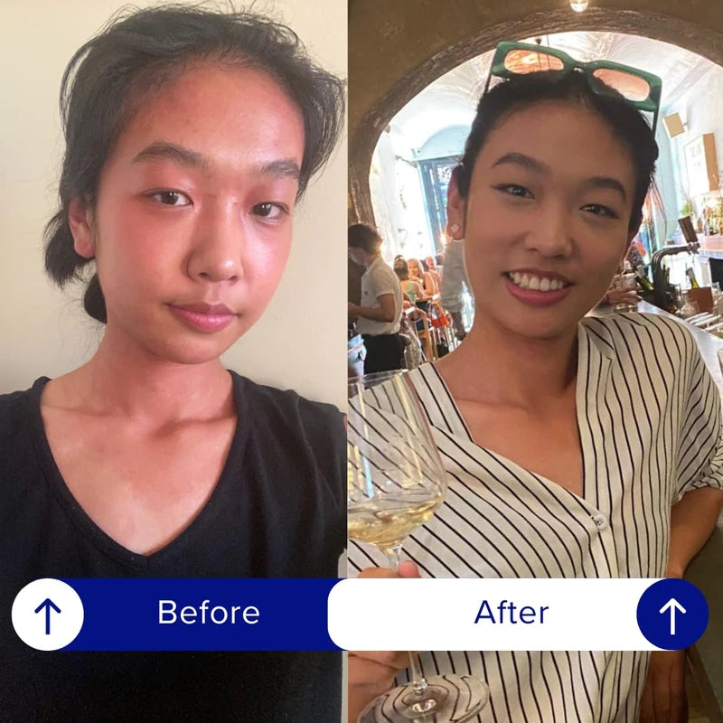 iBlush Asian Flush Patches - 36 Discreet, All Natural Patches Powered By Vitamins & Minerals - Fast, Effective & Backed By Science