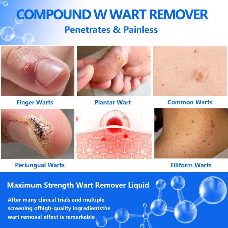HEALMUSZ HEALMUSZ Plantar Warts Remover for Feet, Compound W Wart Remover, Natural Salicylic Acid Fast Acting, Common & Flat Wart Removal Liquid (NDC Code (s) : 84010-004-01)