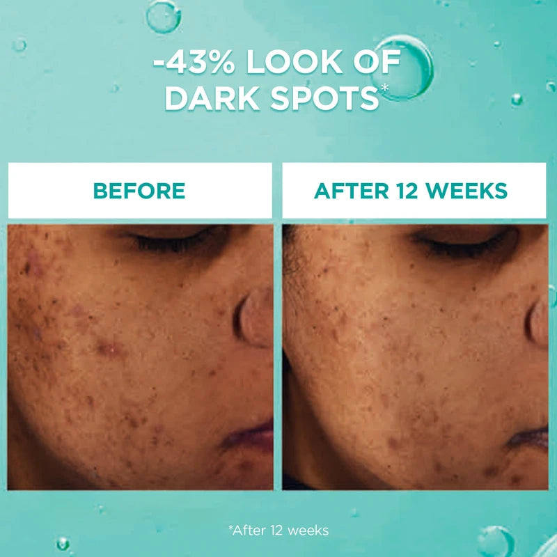 L'Oréal Paris Bright Reveal Dark Spot Face Serum, with 12% Niacinamide + Ferulic + Amino Sulfonic Acids, Reduces the Look of Stubborn Dark Spots, For All Skin Tones, Skincare, 30mL