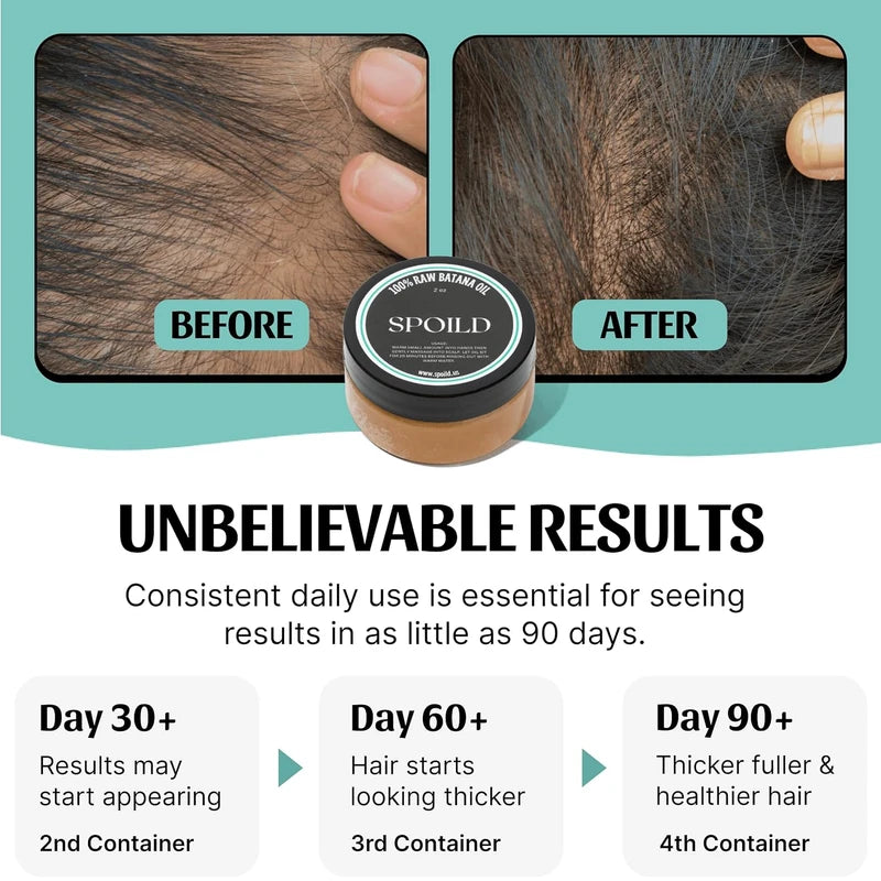 SPOILD Aceite de batana crudo para el crecimiento del cabello, procedente de Honduras, aprobado por el Dr. Sebi, sin refinar y 100% orgánico, evita la pérdida de cabello, fortalece el cabello, 2 onzas