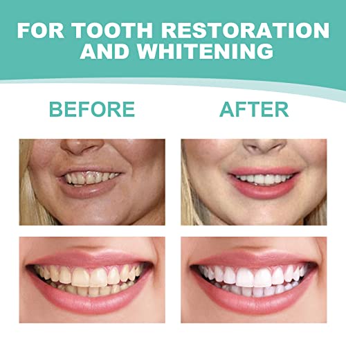 YAFIYGI Snap on Veneers Teeth for Women Small, Dentures with Missing Teeth Clip on Veneers for Men, Snap on Smile Comfort Confident Cover The Imperfect Teeth (3 Pairs)