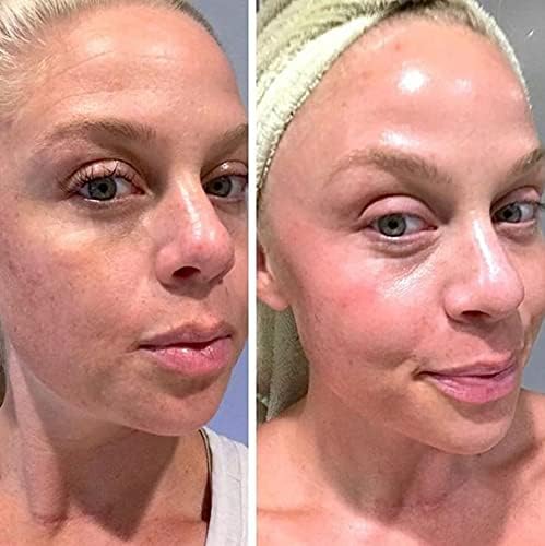 Retinol Gel 0.1 Vitamin A Repairs Fine Lines & Wrinkles, Scar Treatment, Age and Sun Spots, Anti-Aging Formula, 20 Grams