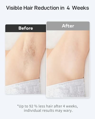 AMOTAOS IPL Laser Hair Removal for Women and Men, Ice-Cooling Laser Hair Removal Device Safe at-Home Epilators for Face Armpits Arms Bikini Line Legs Whole Body