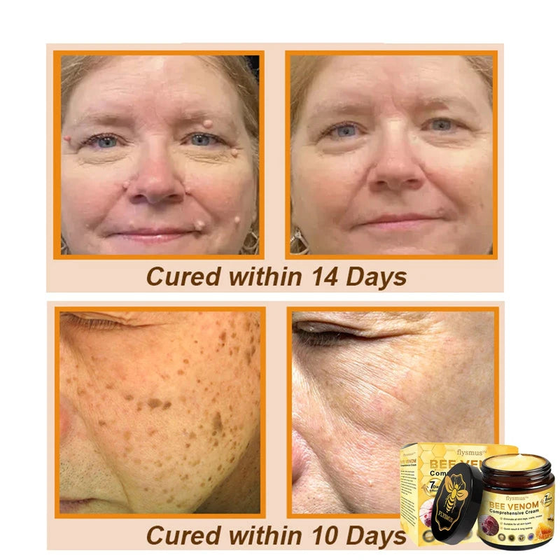 Bee Venom Comprehensive Cream, Professional Bee Venom Skin Treatment Cream for Removing and Repair, Natural Bee Venom Cream Suitable for All Skin Types (3PC)