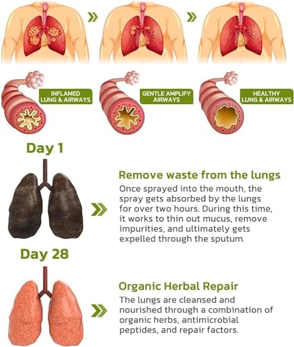 BreathDetox Herbal Lung Cleansing Spray, Herbal Lung Cleanse Spray, Breath Detox Herbal Lung Cleansing Spray, Herbal Lung Cleanse Mist - Powerful Lung Support (4 Pcs)