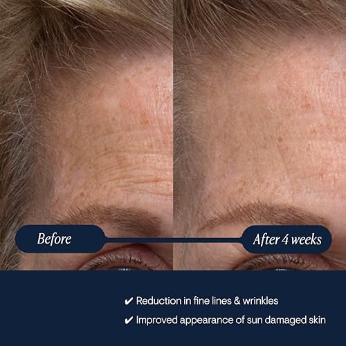 ELEMIS Pro-Collagen Renewal Serum Retinol Alternative Facial Concentrate Rejuvenates, Firms and Reduces the Look of Fine Lines and Wrinkles 15 mL