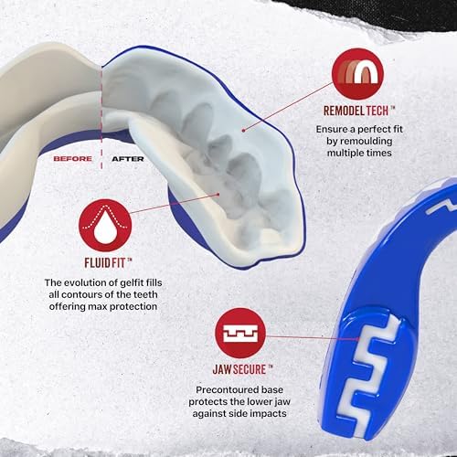 SafeJawz Sports Mouthguard, Dual Layer Premium Mouth Guard with Case for Basketball, Lacrosse, Football, Martial Arts, Hockey, Wrestling, Ice Hockey and All Contact Sports