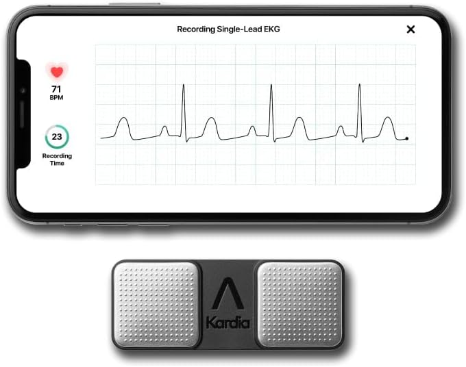 KardiaMobile 1-Lead Personal EKG Monitor – Record at Home – Detects AFib & Irregular Arrhythmias – Easy Results in 30 Seconds – Works w/Most Smartphones - FSA/HSA Eligible