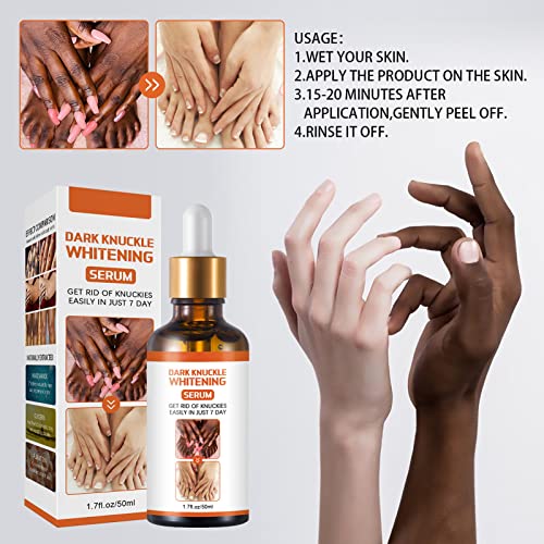 Dark Knuckle Whitening Serum, 1.7 Fl Oz Joint Darkening Serum, Lighten And Repair Melanin, Skin Care Removal Body Bleaching For Knuckle Elbows