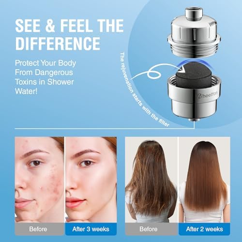 Wheelton Shower Filter - Upgraded Compressed Carbon Shower Head Filter for Hard Water, Remove Chlorine Fluoride, Heavy Metals, Chemicals to Revitalize Dry Itchy Skin Vitamin C Shower Water Filter