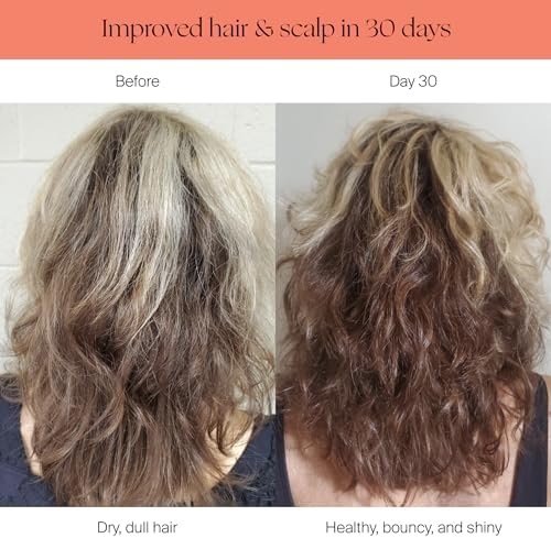 Canopy Filtered Shower Head - High Pressure Shower Head Filter for Hard Water - Shower Filter To Remove Impurities for Healthier Scalp, Skin & Hair - Support Hair Growth & Minimize Breakage - Chrome