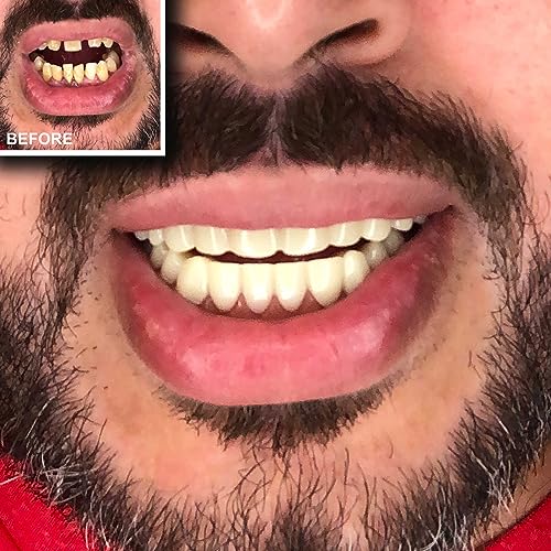 Instant Smile Comfort Fit Flex Teeth - Upper and Lower Matching Set, Natural Shade! Fix Your Smile at Home Within Minutes!