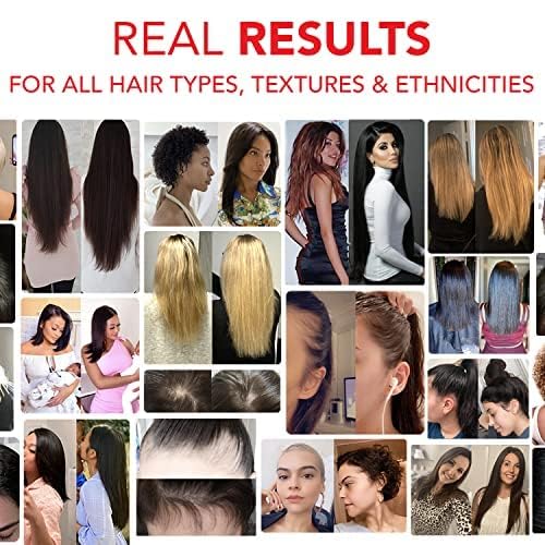 HAIRtamin Advanced Hair & Scalp Serum Pack | All-Natural Vegan Biotin Capsules & Serum Sample for Hair, Skin & Nail Growth