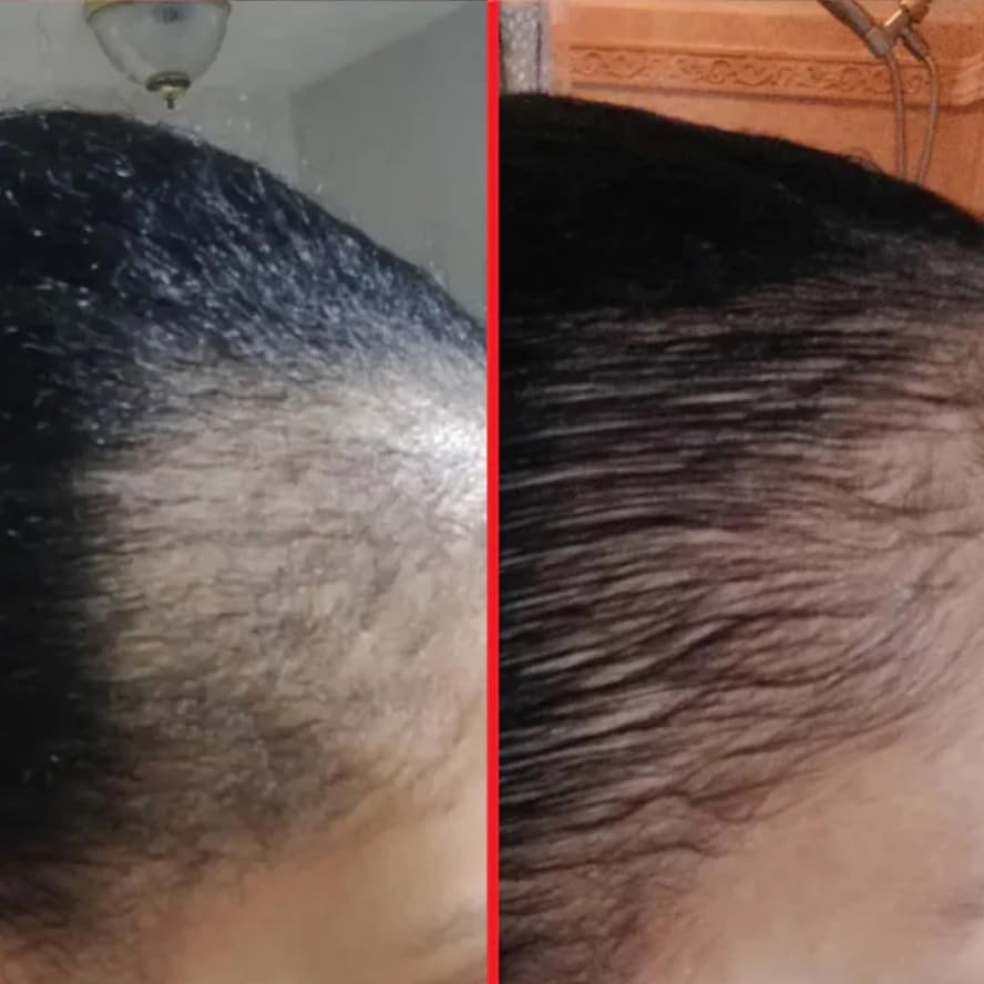 HAIRtamin Advanced Hair & Scalp Serum Pack | All-Natural Vegan Biotin Capsules & Serum Sample for Hair, Skin & Nail Growth