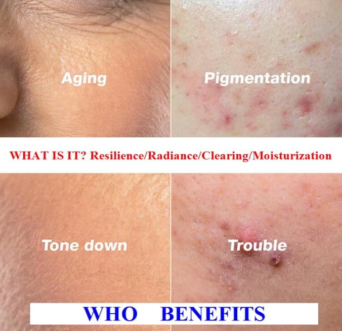 WHITESILK (4%) PDRN & (6%) Proteoglycan Complex Skin Healer Serum┃Anti-Aging, Repair, Lifting, Moisturizing (30ml, 1oz)