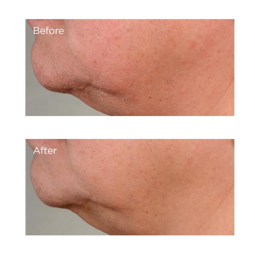 High Potency Growth Factor Firming & Lifting Serum, 2 fl. oz.