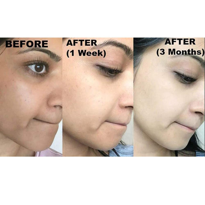 Kojie San Skin Brightening 2 Piece Set - The Original Kojic Acid Soap that Reduces Dark Spots, Hyperpigmentation, and Other types of Skin Damage – 65g x 2 Bars & 30g Face Cream