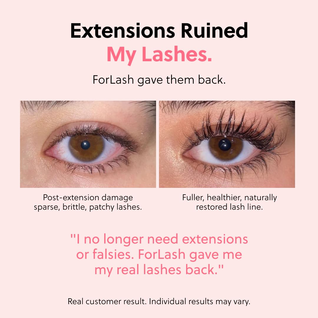 ForChics Prostaglandin-Free Eyelash Growth Serum – Rebuilds Thin Lashes