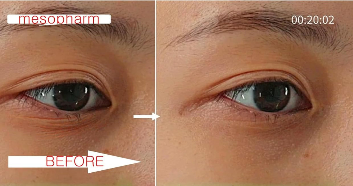 WHITESILK (4%) PDRN & (6%) Proteoglycan Complex Skin Healer Serum┃Anti-Aging, Repair, Lifting, Moisturizing (30ml, 1oz)