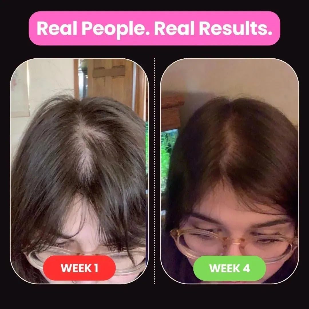 10 in 1 Hair Growth Oil (2 Oz) | Formulated With African Chebe Powder For Extreme Hair Growth, 2 Fl Oz (Pack of 1), 2.0 ounces