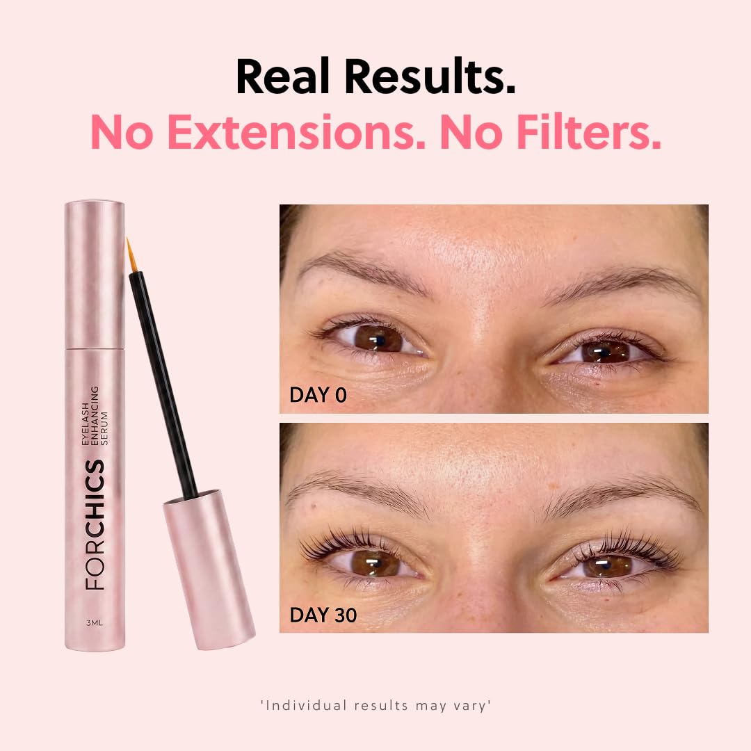 ForChics Prostaglandin-Free Eyelash Growth Serum – Rebuilds Thin Lashes