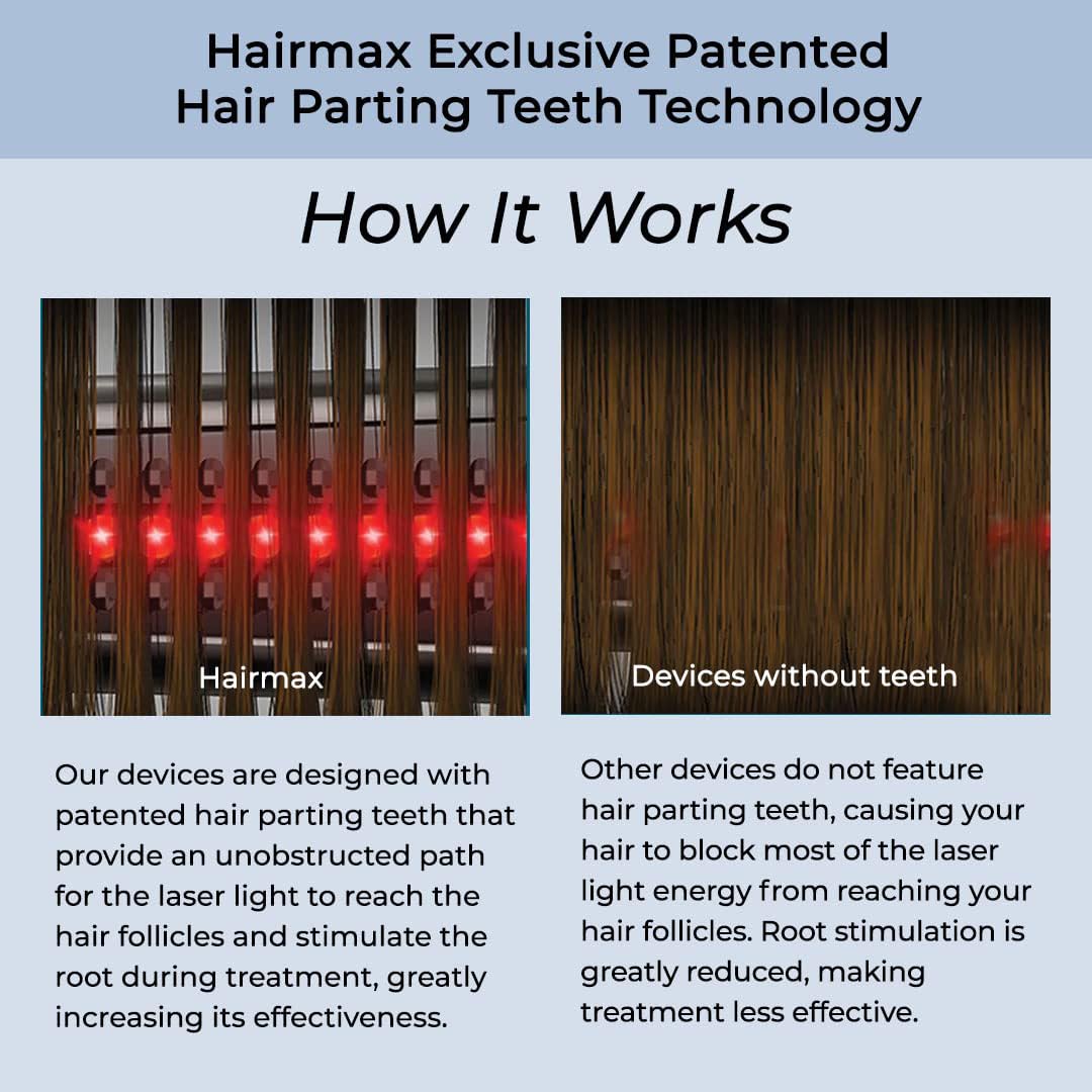 Hairmax Ultima 12 Classic LaserComb- (FDA Cleared) Laser Hair Regrowth Treatment Device for Men & Women - Reverses Thinning Hair Loss - Red Light Therapy to Stimulate Hair Growth - Cordless Design