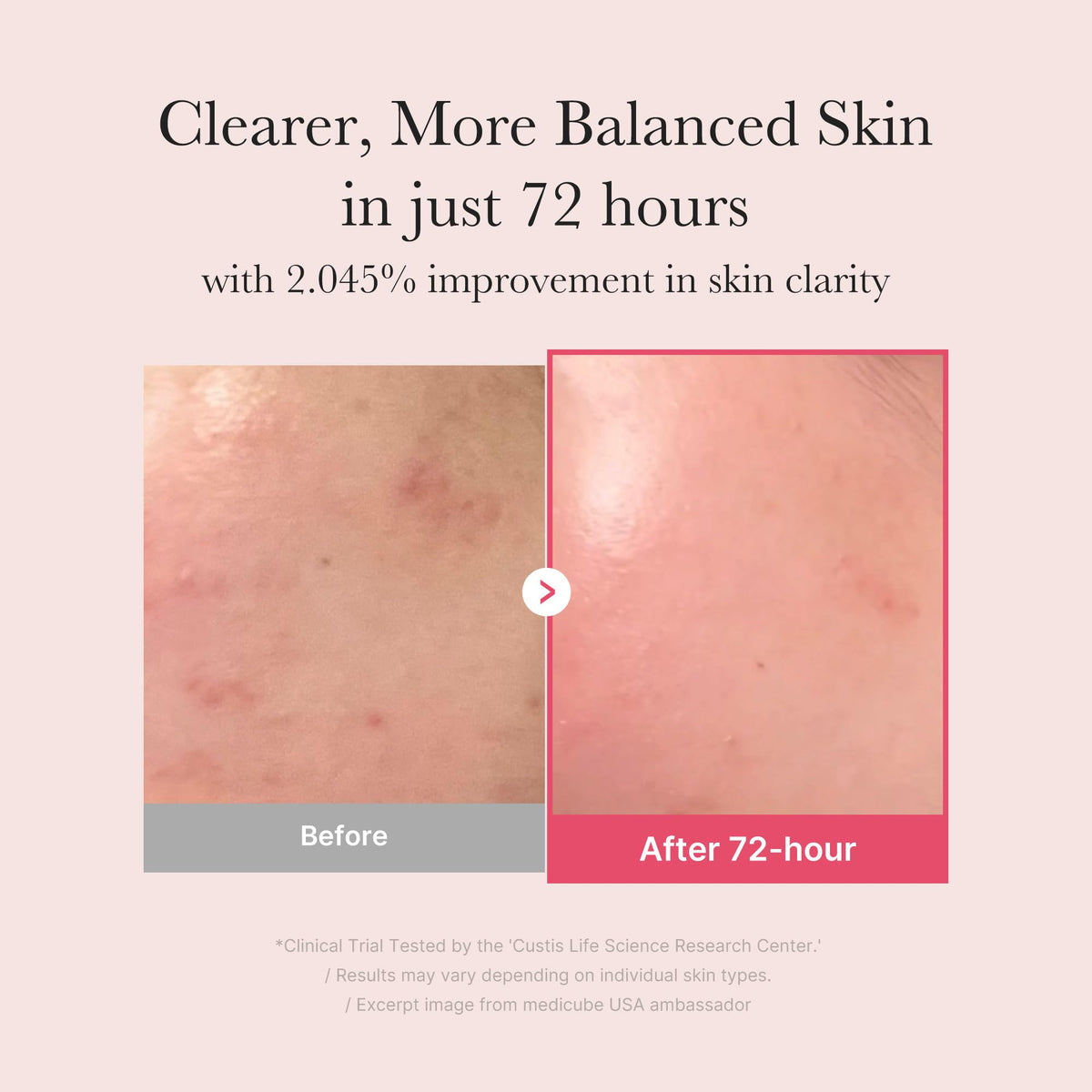 medicube TXA&Niacinamide 15% Glow Serum