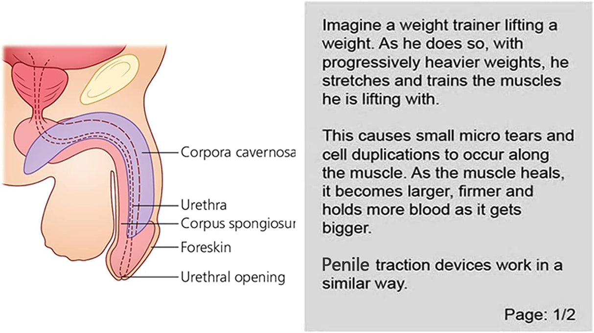 Penile Traction Devices for Men Massage Kit Massage Men's Bracket Kit Physical Increase Size