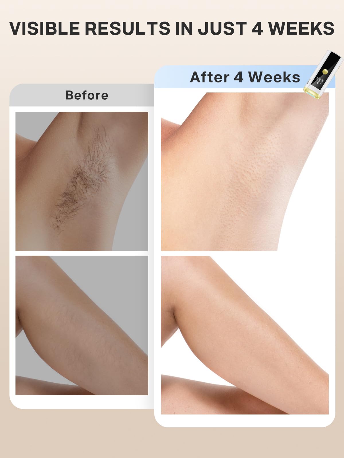 Hair Removal for Women and Men, At Home IPL Hair Removal Device with 3 Modes, Permanent Hair Remover Machine for Facial Legs Arms Bikini Line Whole Body Depilation, Come with Razor & Glasses