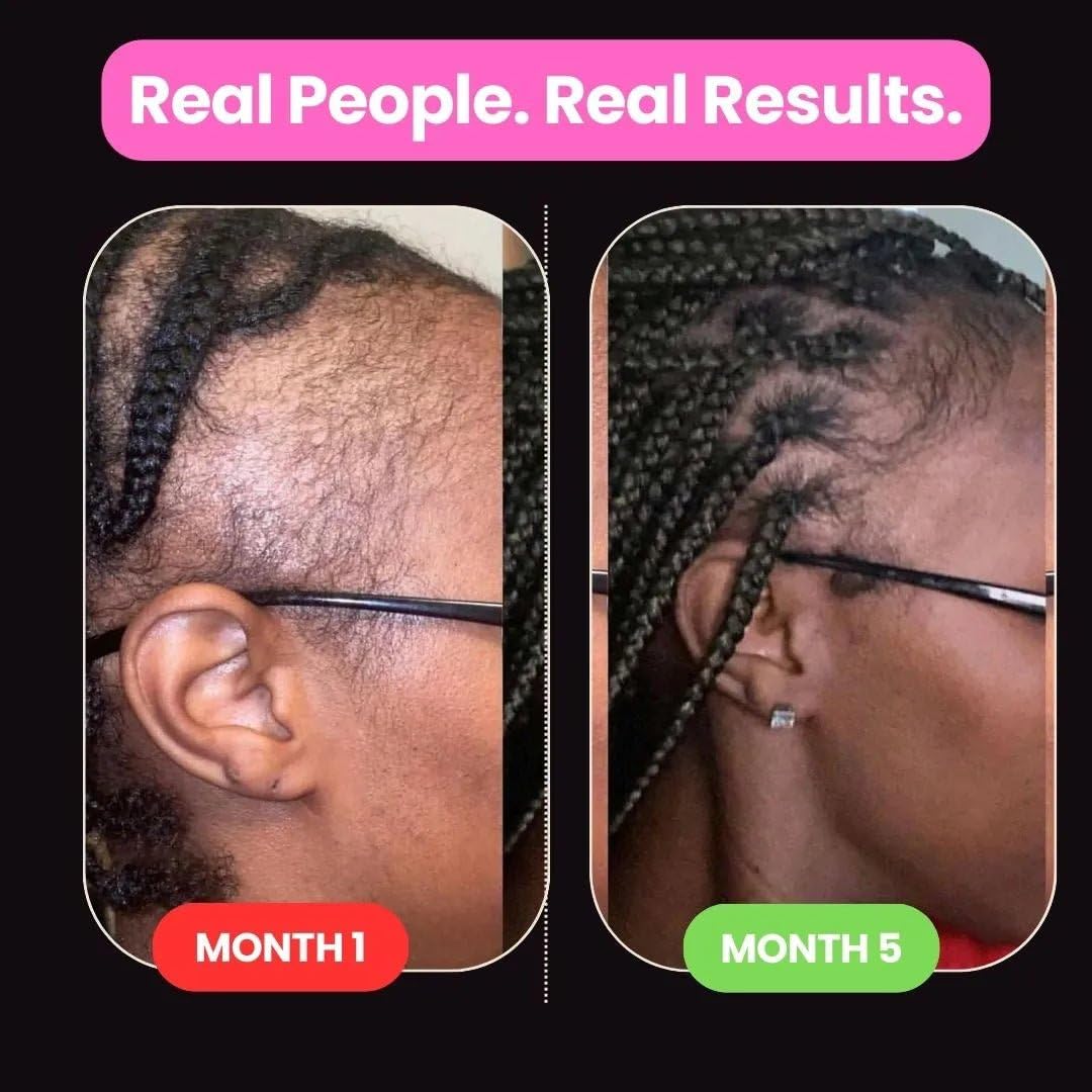 10 in 1 Hair Growth Oil (2 Oz) | Formulated With African Chebe Powder For Extreme Hair Growth, 2 Fl Oz (Pack of 1), 2.0 ounces