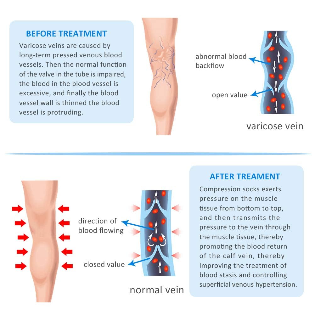 20-30mmHg Compression Pantyhose for Women, Medical Compression Stockings, High Waist Opaque Compression Tights for Lymphadema Edema, Swelling, Varicose Veins, Support Hose for Teacher Doctor (L,