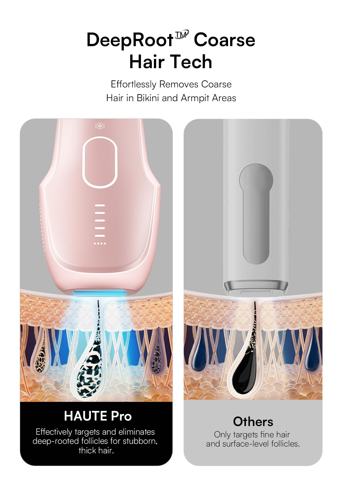 INIA Laser Hair Removal with Ice-Cooling Care for Women and Men, Painless at-Home IPL Hair Remover for Coarse Hair in Bikini and All Body Areas, Latest Generation for Effective Results (Pink)