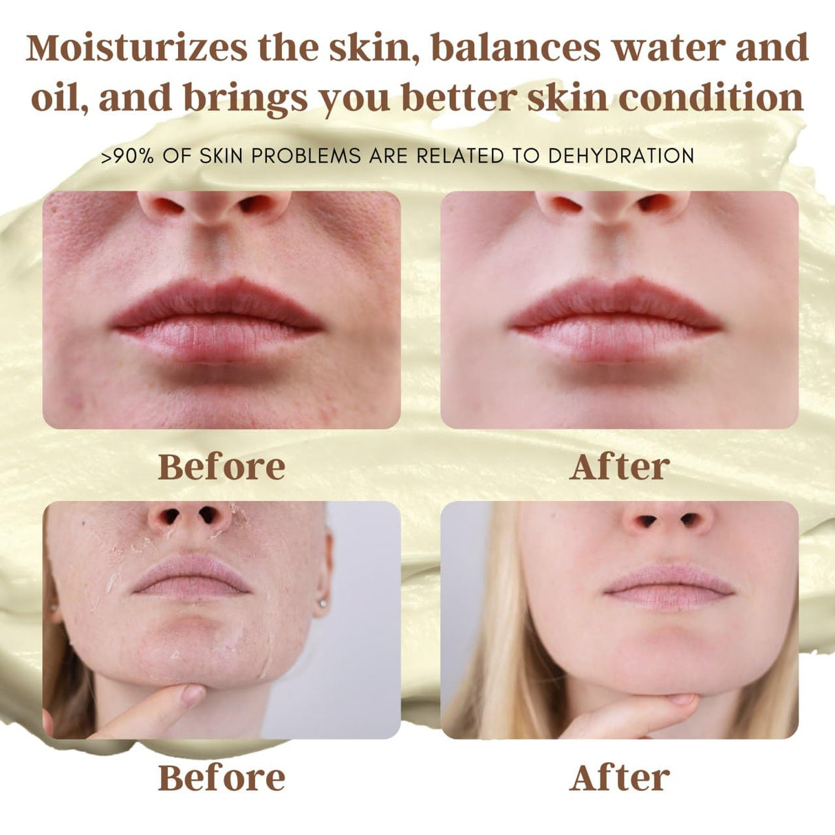 FRANDORA Beef Tallow & Honey Balm – All-Natural Moisturizer Hydrates and Nourishes the Skin, Grass-fed Beef Tallow Honey Balm blend - Ultra-Nourishing Moisturizer for Face, Body & Hands.