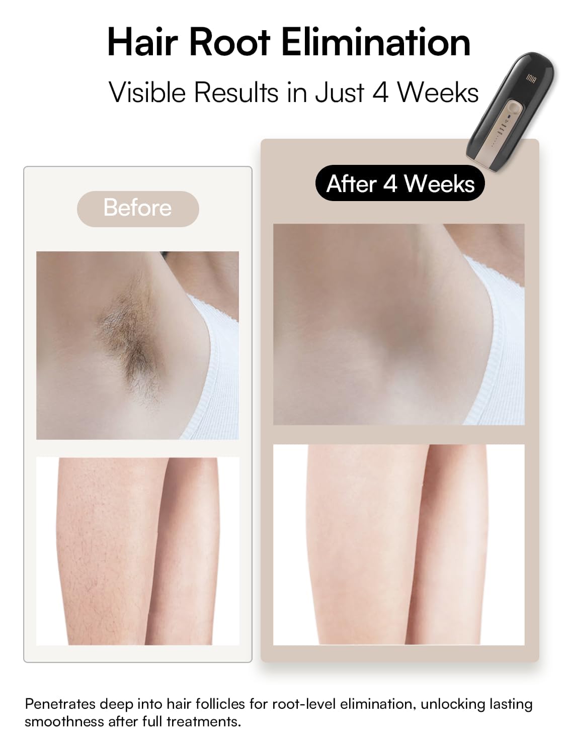 Laser Hair Removal Device for Women and Men, INIA Fond Hair Remover with Long-Lasting in Hair Reduction for Body&Face, Safe at-home Results for Armpits, Bikini and Legs