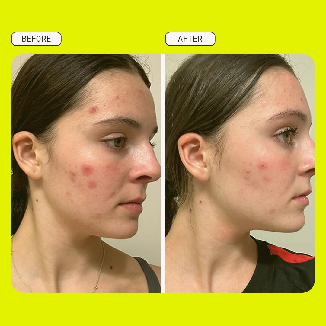 Evereden Preppy Skincare Collection with Triple Green Tea: Teen Skincare Steer Clear Balancing Jelly Cleanser Teen Face Wash, Let's Bounce Gel-Cream Moisturizer, & Balance Up Toner Pads for Face