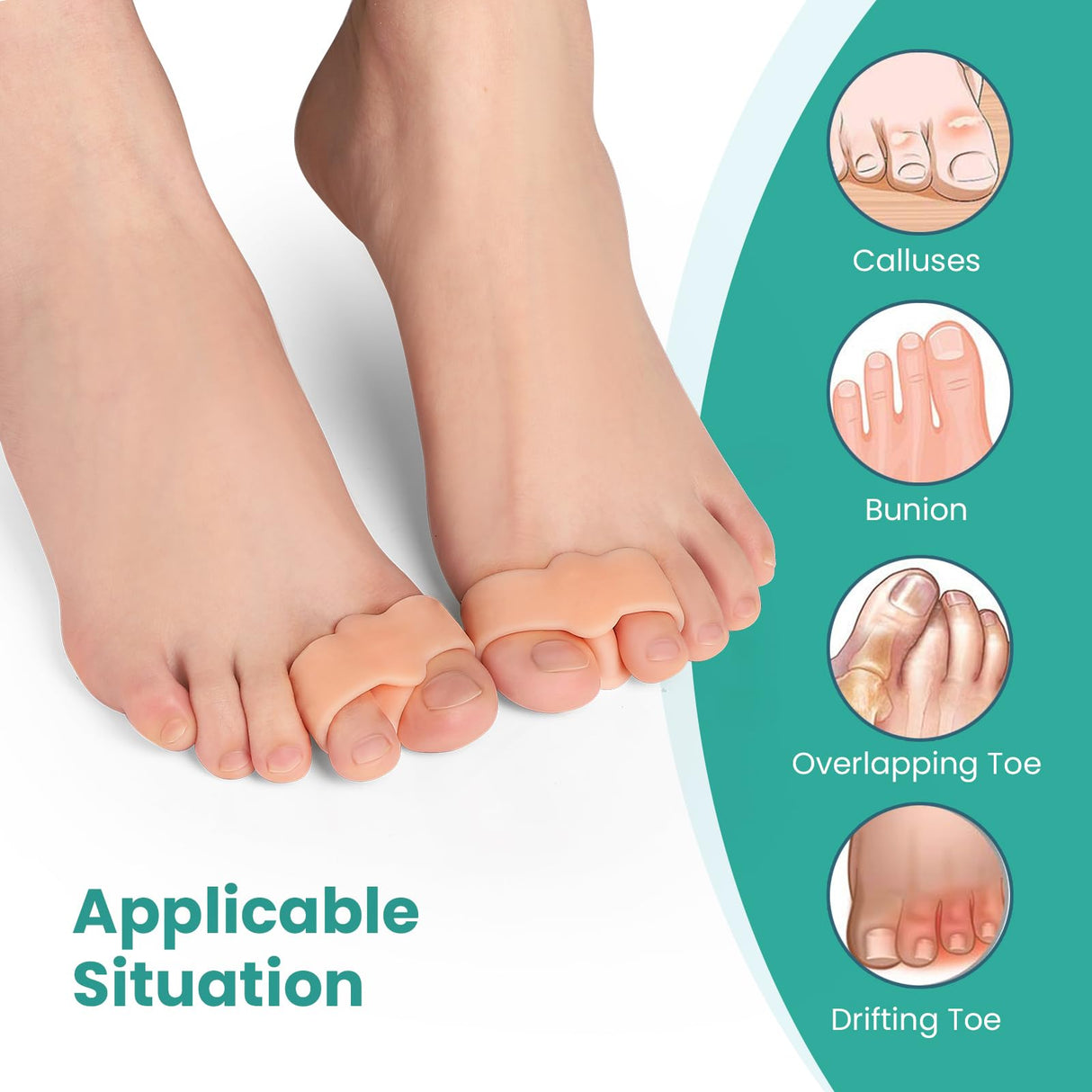Welnove Pack of 12 Bunion Corrector