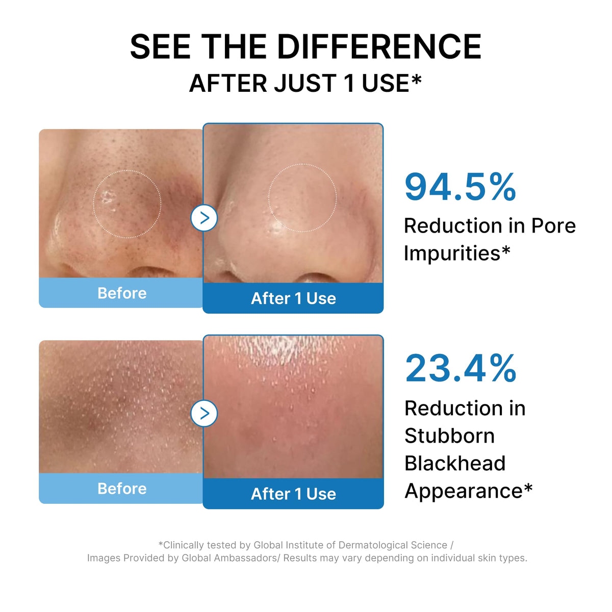 medicube Cleansing Oil Zero Pore, Makeup Remover, Blackhead & Pore Care