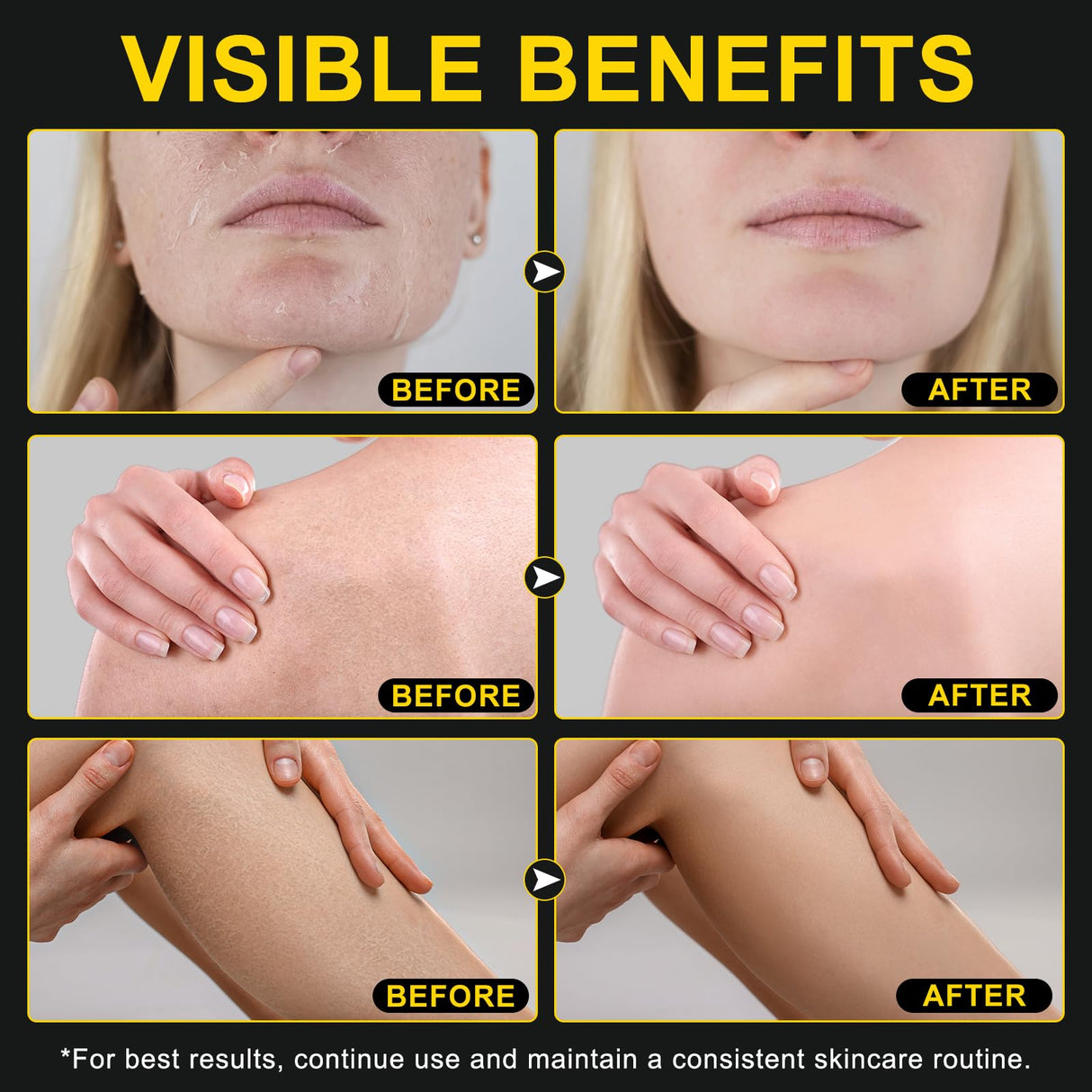 KZUO Beef Tallow for skin, Beef Tallow, Hydrating Tallow Balm with Raw Honey and Beeswax, Grass-Fed Beef Tallow & Raw Wild Honey Blend, Body & Face Moisturizer, Natural Formula