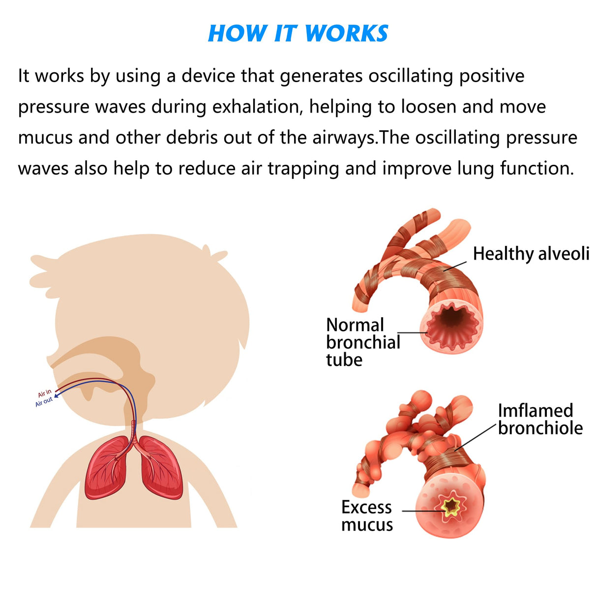 MILLSTEPS Breathing Exercise Device for Lungs,Mucus Relief and Lung Expansion Device - Clear Mucus from Airways Naturally & Build Stronger Lungs