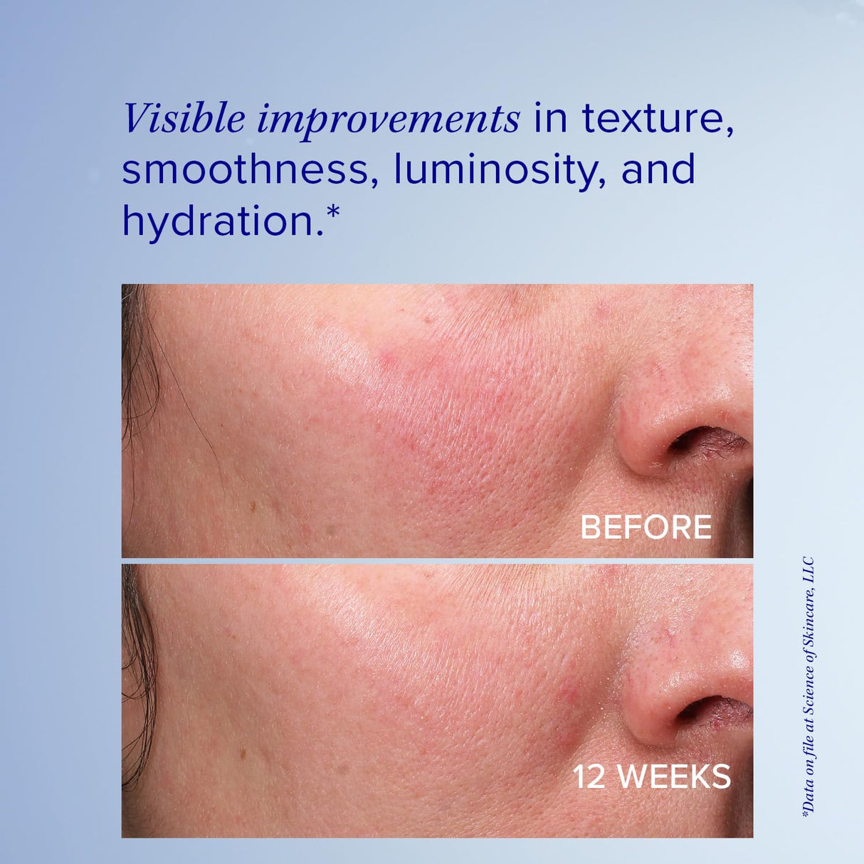 iS Clinical Retinol+ Emulsion 0.3, reduce fine lines and wrinkles, smooths appearance, helps brighten complexion