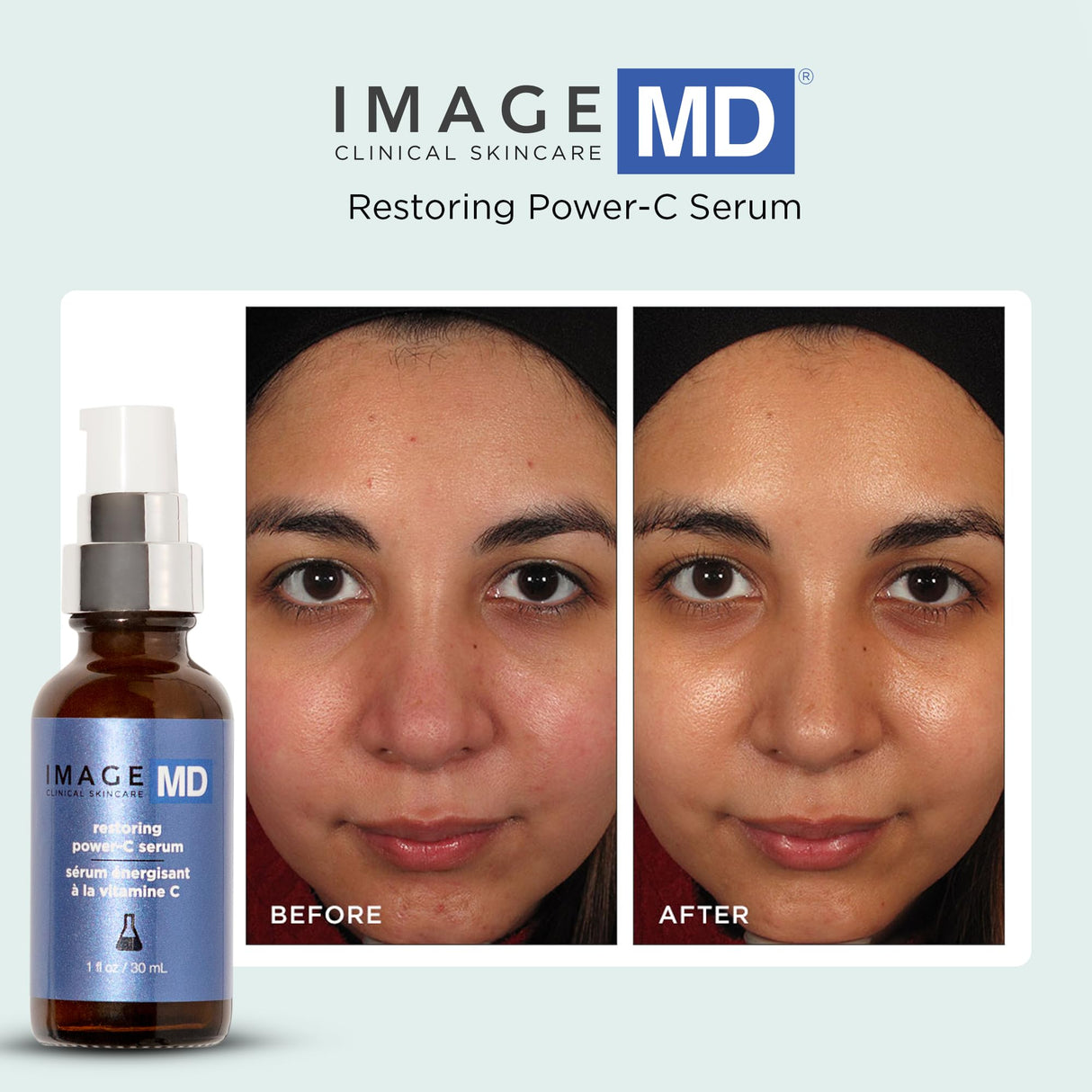 Image Skincare Restoring Power-C Serum 30 ml / 1 oz