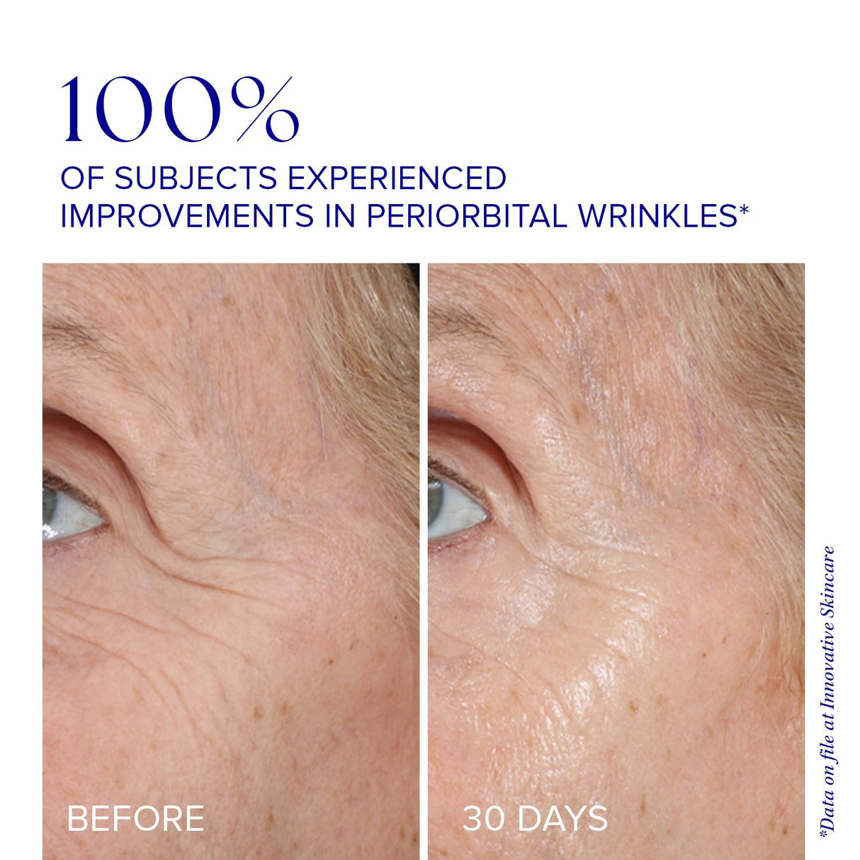 iS CLINICAL Youth Eye Complex, Anti-Aging Brightening Under Eye Cream, Reduces Puffiness, Hydrating and Firming Eye Cream