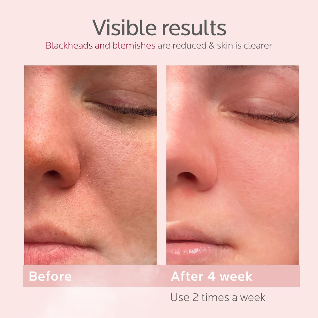 Colorfarm Facial Steamer Nano Ionic: Face Steamer Home Spa Kit Deep Cleaning Unclogs Pores Sinuses Inhaler with 8 Skin Care Tools - Self Care Gifts for Women (Deep Cleansing Facial Kit)