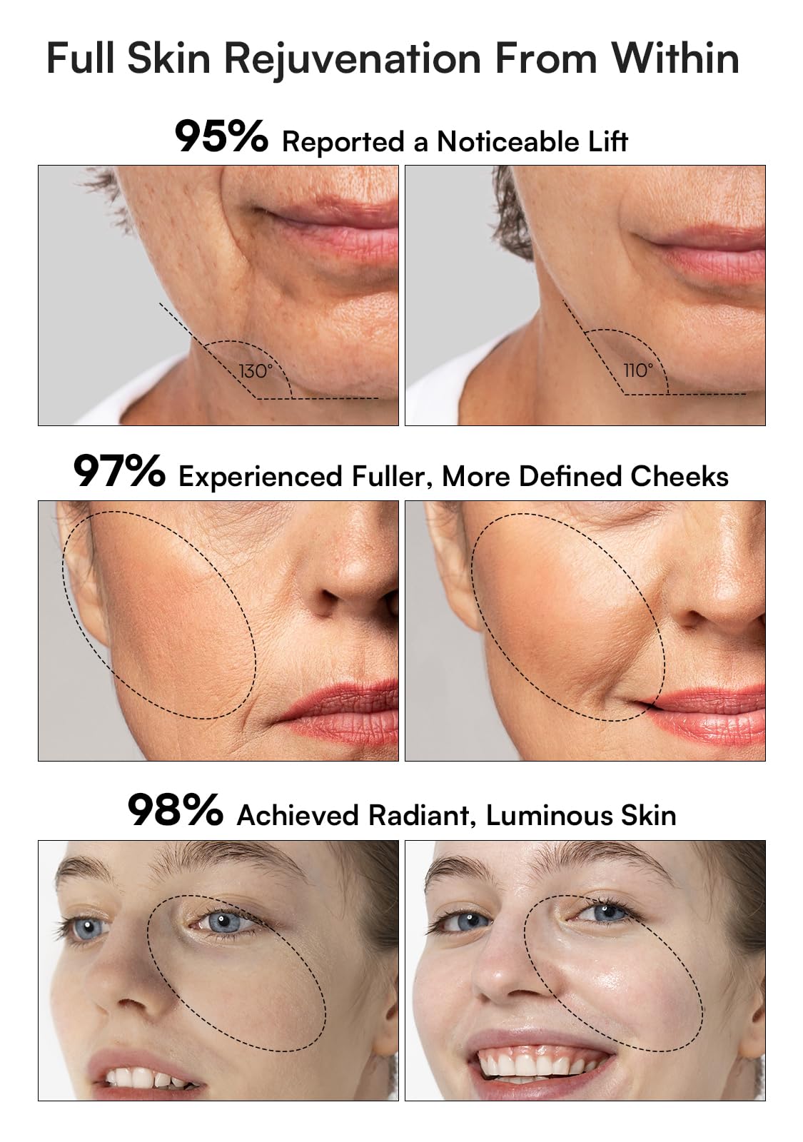 INIA Microcurrent Facial Device, 3-in-1 Facial Massager Red Light Therapy Beauty Device for Face and Neck Skin Rejuvenation Lifting, Tightening, Infusing, Effective Wrinkle and Puffiness Reduction