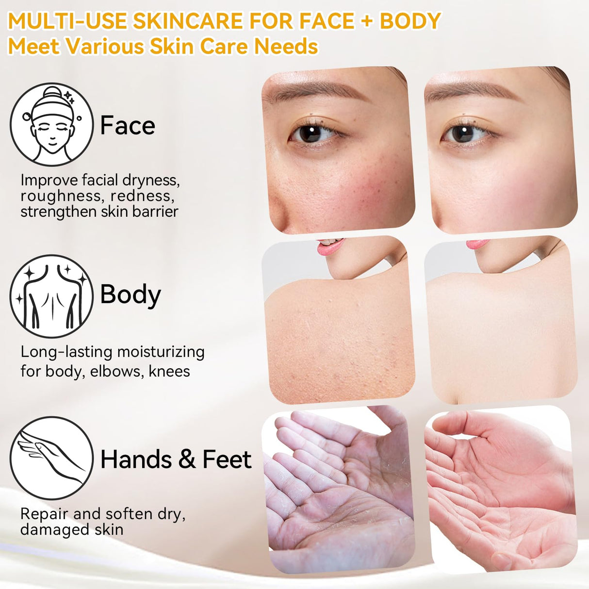 Beef Tallow for Skin, Whipped Tallow and Honey Balm, Organic Grass-Fed Beef Tallow with Raw Honey & Beeswax Natural Moisturizer for Face & Body, Nourish and Soothe Sensitive, Dry Skin