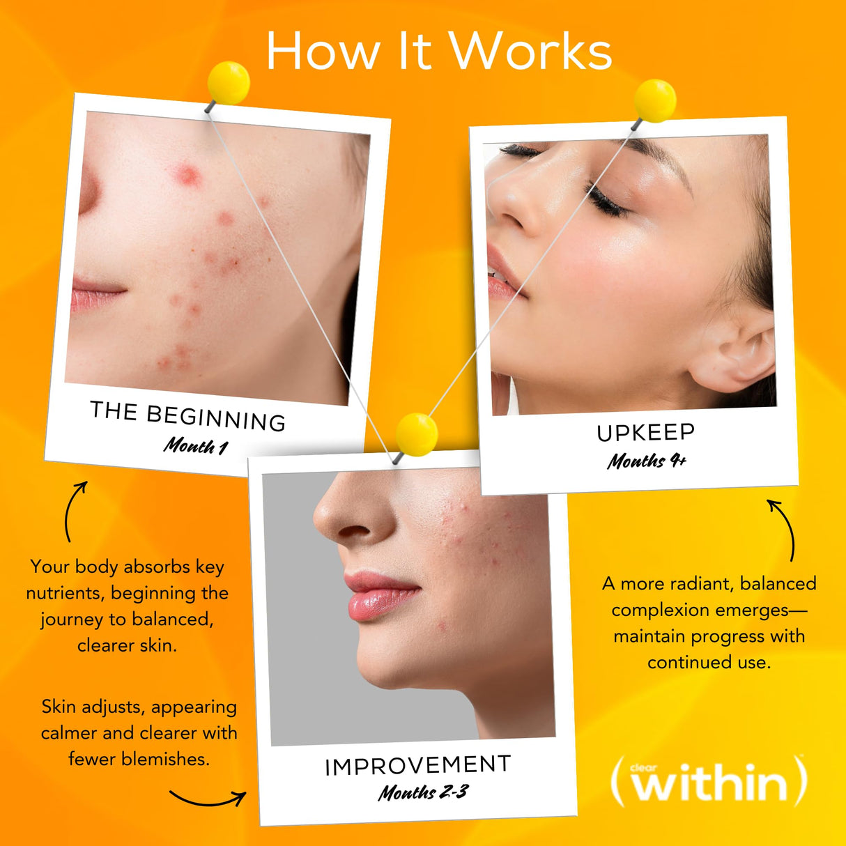 Clear Within Clear Skin Vitamin - with 10 Natural Ingredients for Acne-Free, Clearer Complexion, Oil Control & Blemish Minimization. Supports Skin Clarity | Non-Synthetic 60 Cap/Bottle