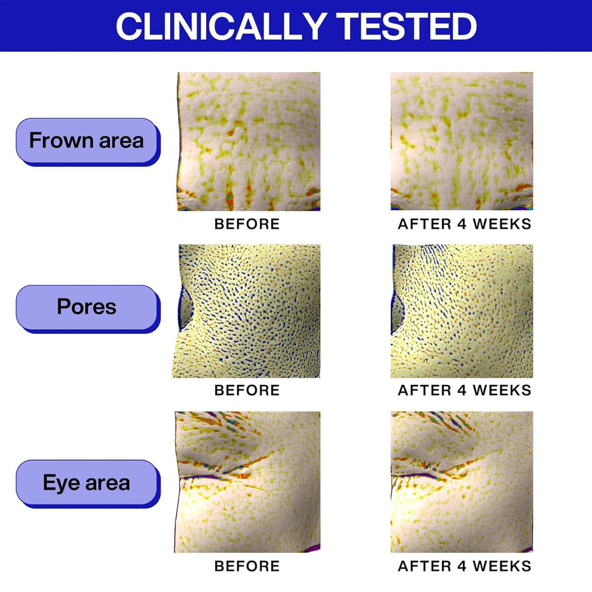 IOPE Retinol Super Bounce Serum - Daily Korean Skincare for Anti-Aging, Reduction in Fine Lines & Wrinkles, Beginner Friendly, Gentle Nourishment for Sensitive Skin, 1.69 Fl Oz.