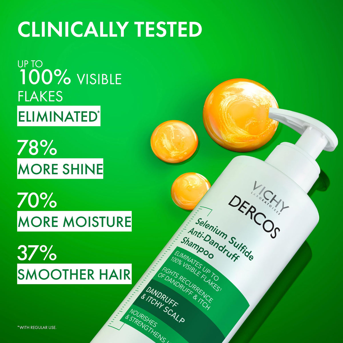 VICHY Dercos Dandruff Shampoo, Antifungal Itchy Scalp Treatment, 13.8 oz